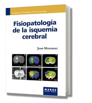 FISIOPATOLOGIA DE LA ISQUEMIA CEREBRAL | 9788486684839 | MONTANER VILLALONGA, JOAN/Y OTROS