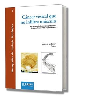 CANCER VESICAL QUE NO INFILTRA MUSCULO | 9788486684792 | GELABERT, ANTONI